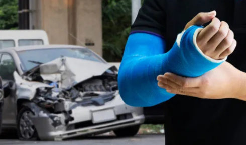 Finding the Best Accident Care Doctor Near You for Quick Recovery