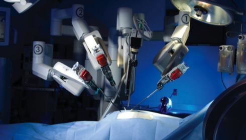 Robotic Surgery in Bangalore: Advancing Precision and Patient Care